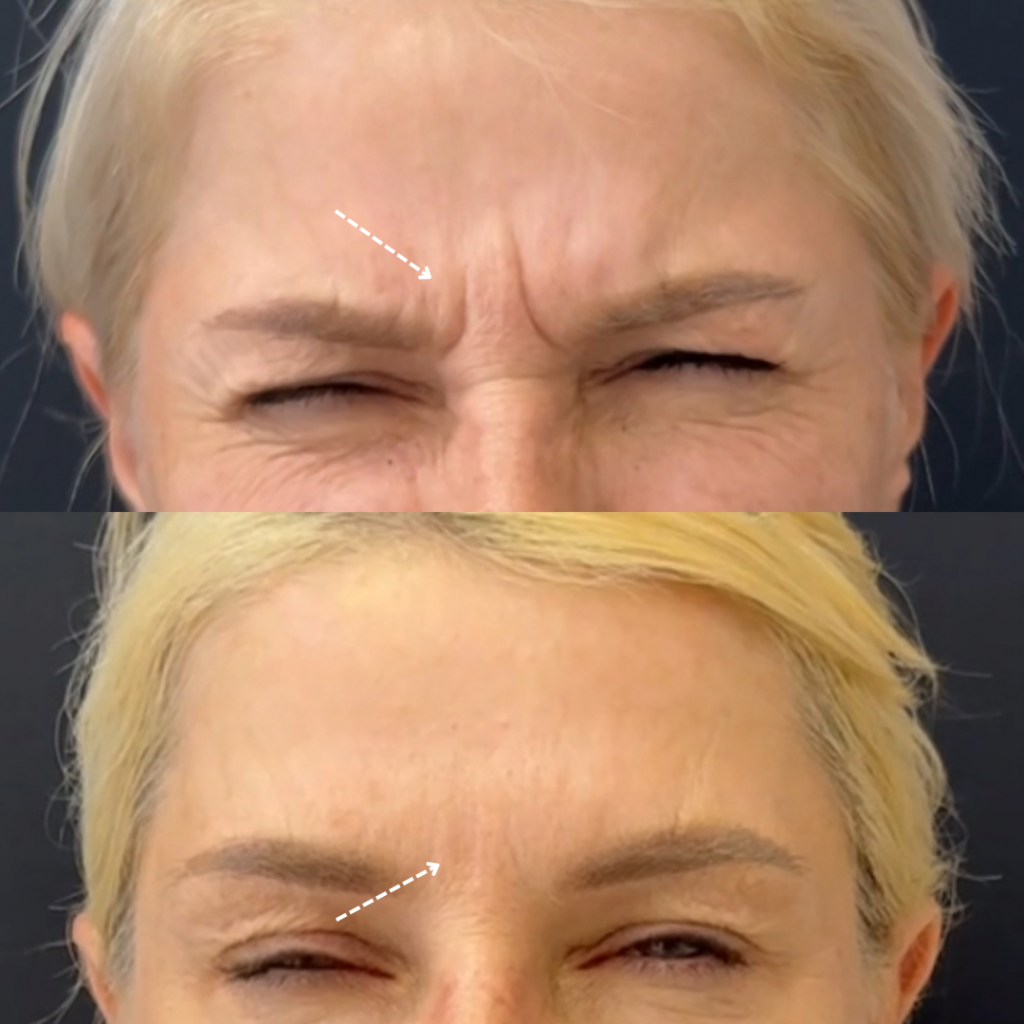 Untitled design - 1 (1).png